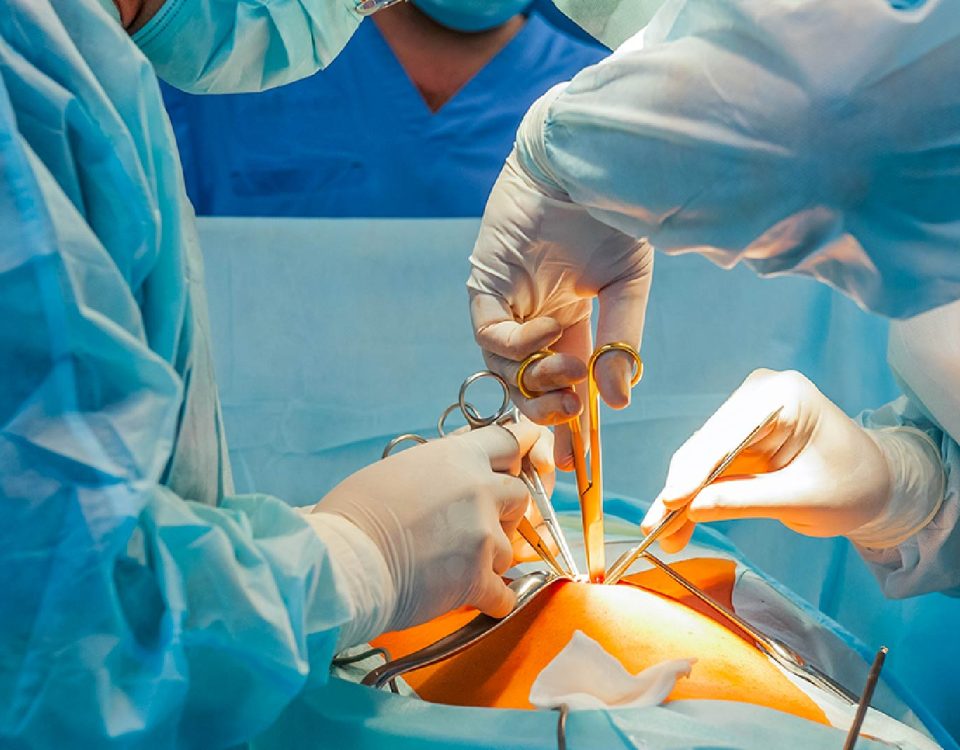 hysteroscopy surgery